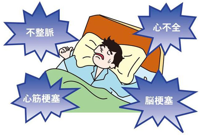 睡眠時無呼吸症候群